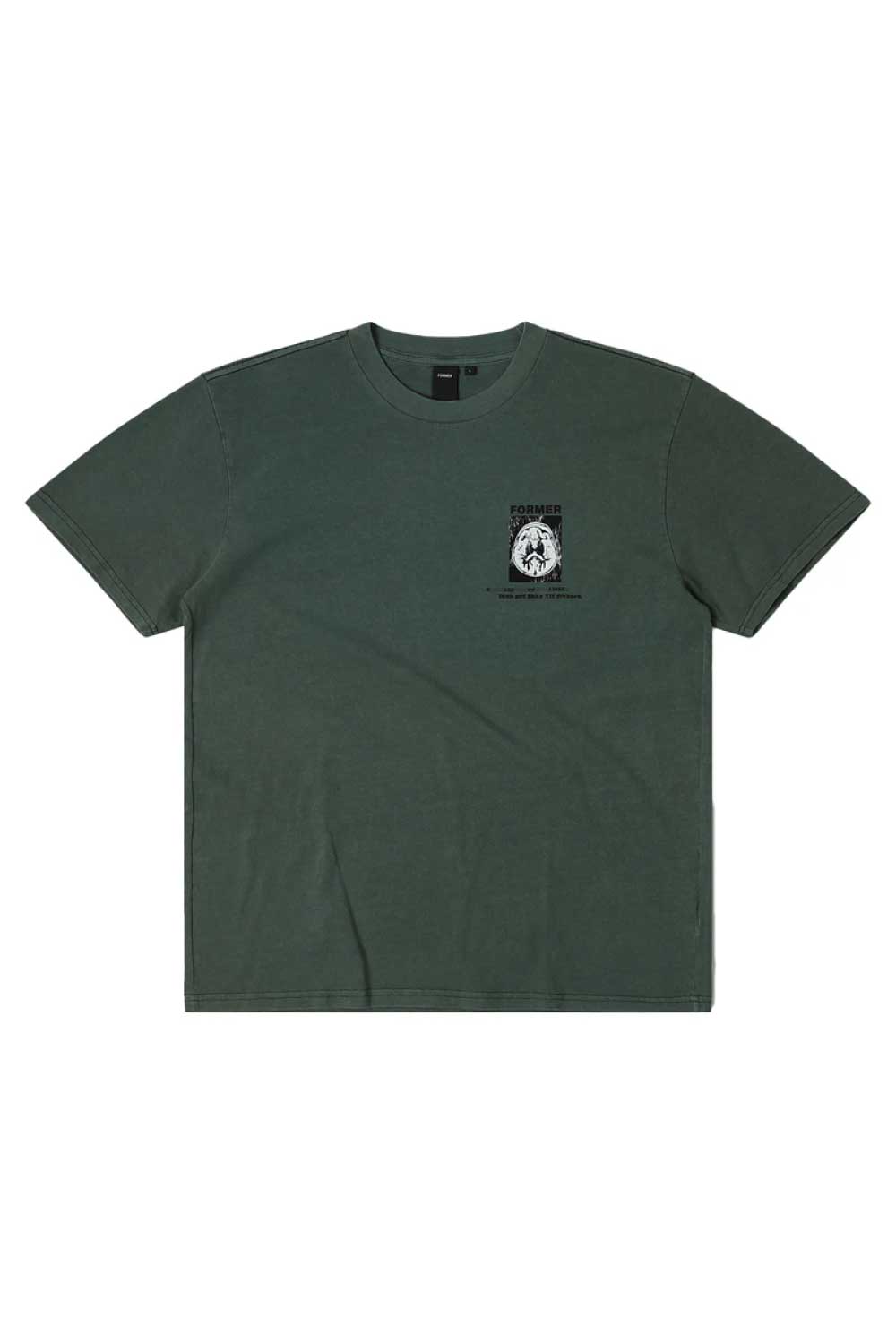 Former Brain Scan Oversized T-Shirt